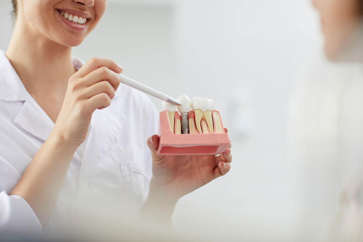 Dental Implants Common Myths and Misconceptions Debunked