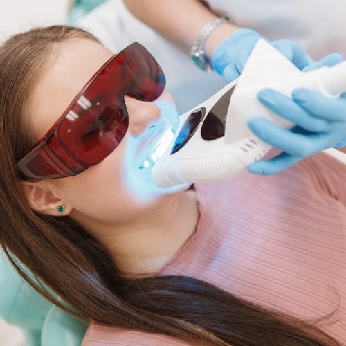 Professional Teeth Whitening in Scarborough